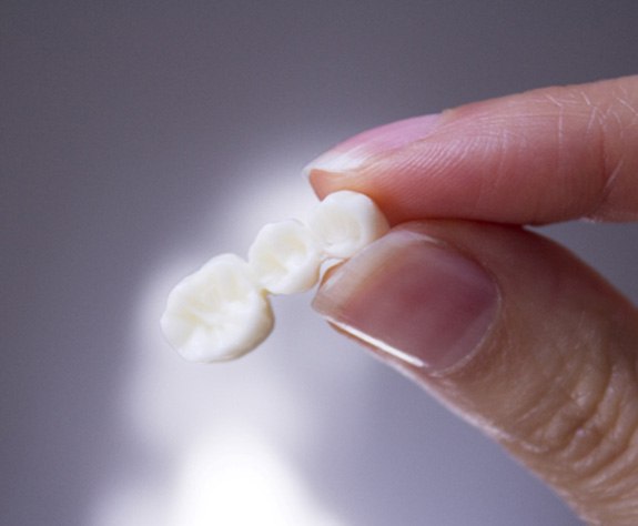 hand holding a dental bridge 