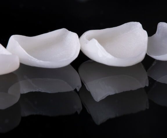 Metal free dental crowns prior to placement