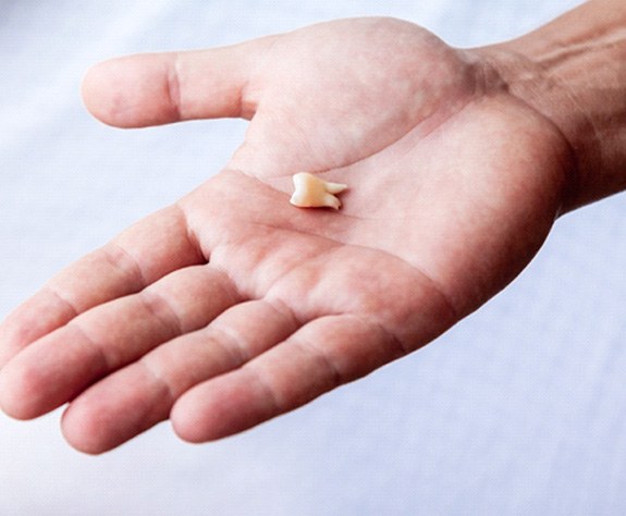 Person holding a tooth in their hand.