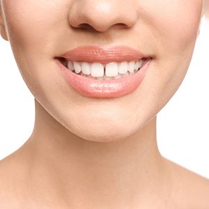 Woman’s smile with gap between the front teeth