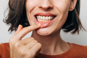 a woman smiling and showing her gums